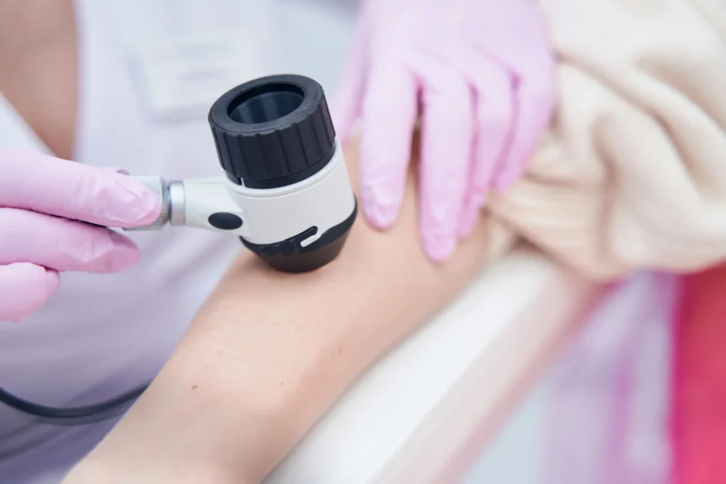 Practitioner performing a skin treatment using a handheld medical device on a patient’s arm.